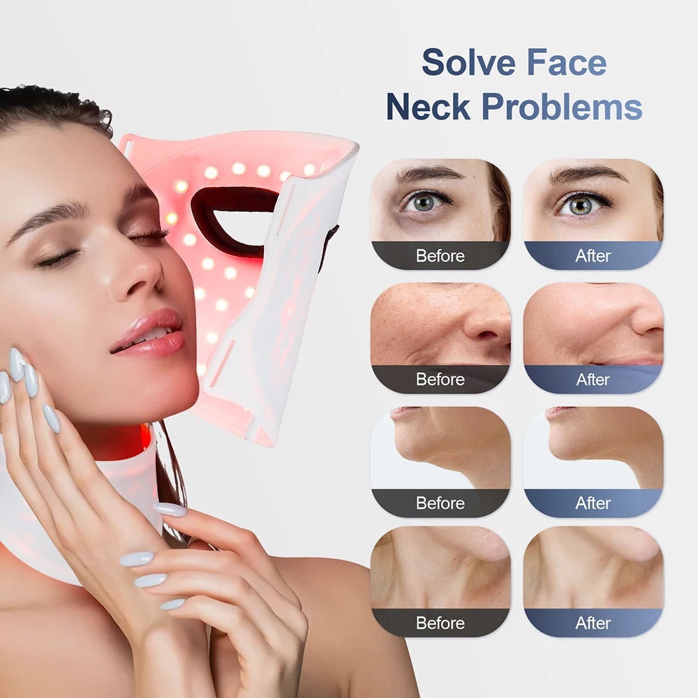 Zonevera™ Red Light Therapy Mask